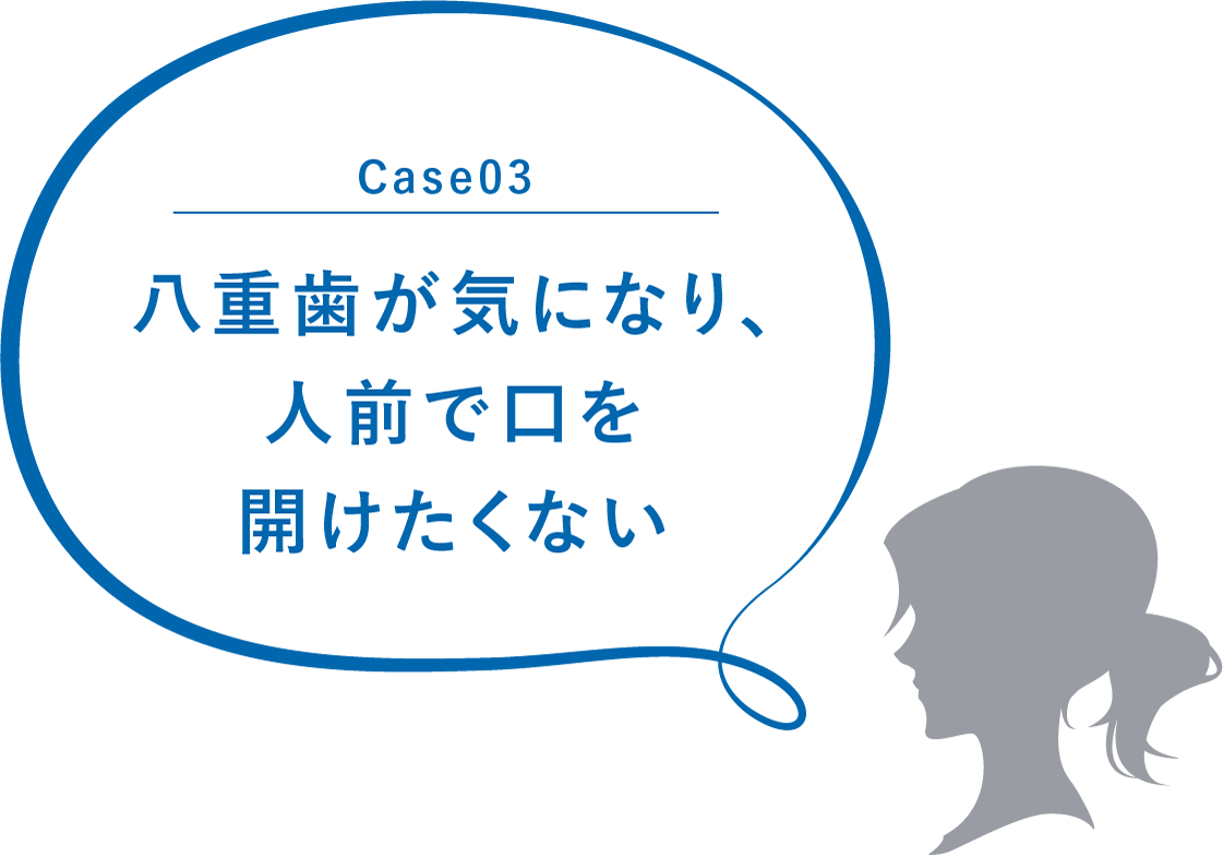 Case03 八重歯が気になり、人前で口を開けたくない