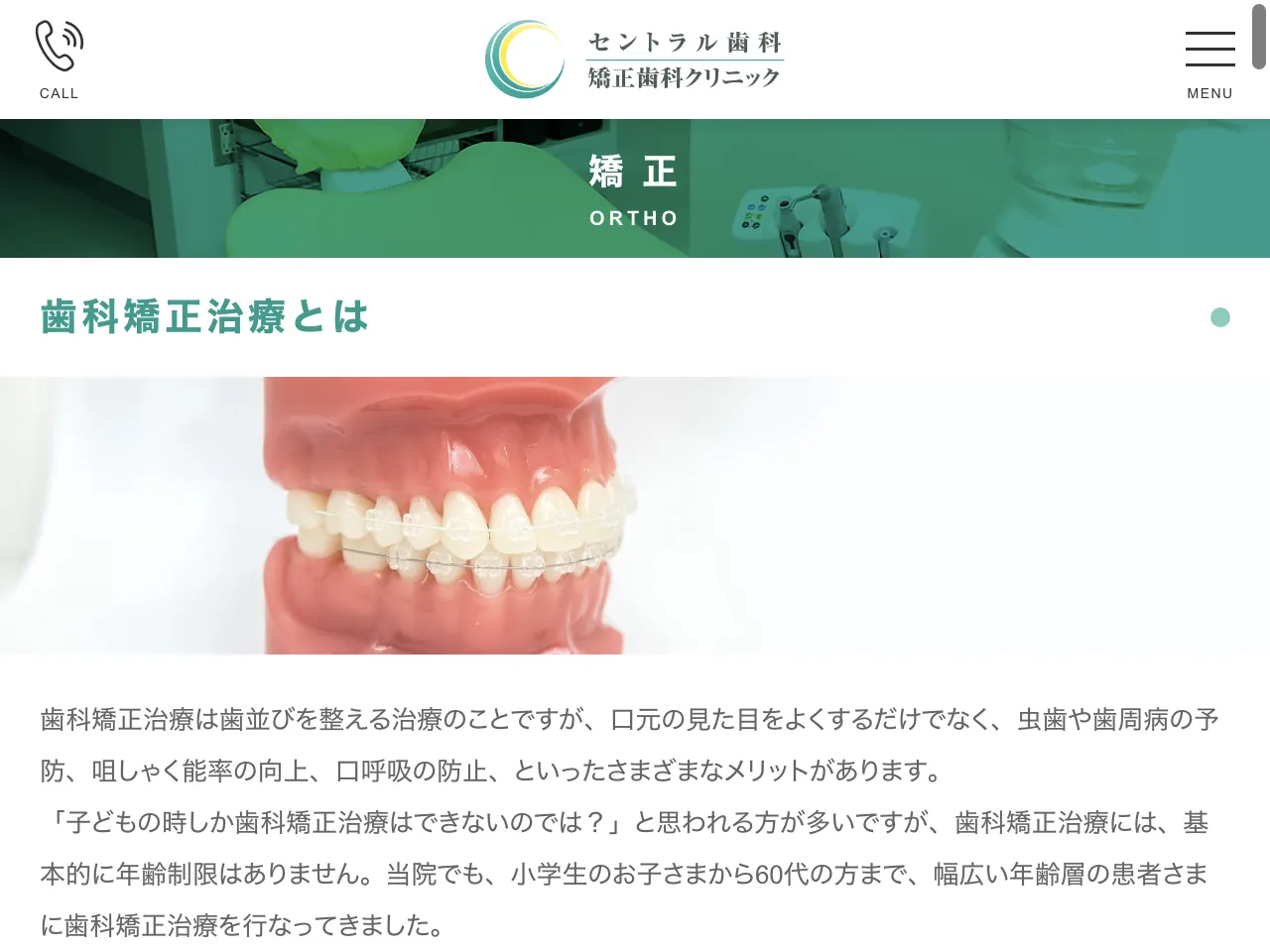 セントラル歯科 矯正歯科クリニックのウェブサイト